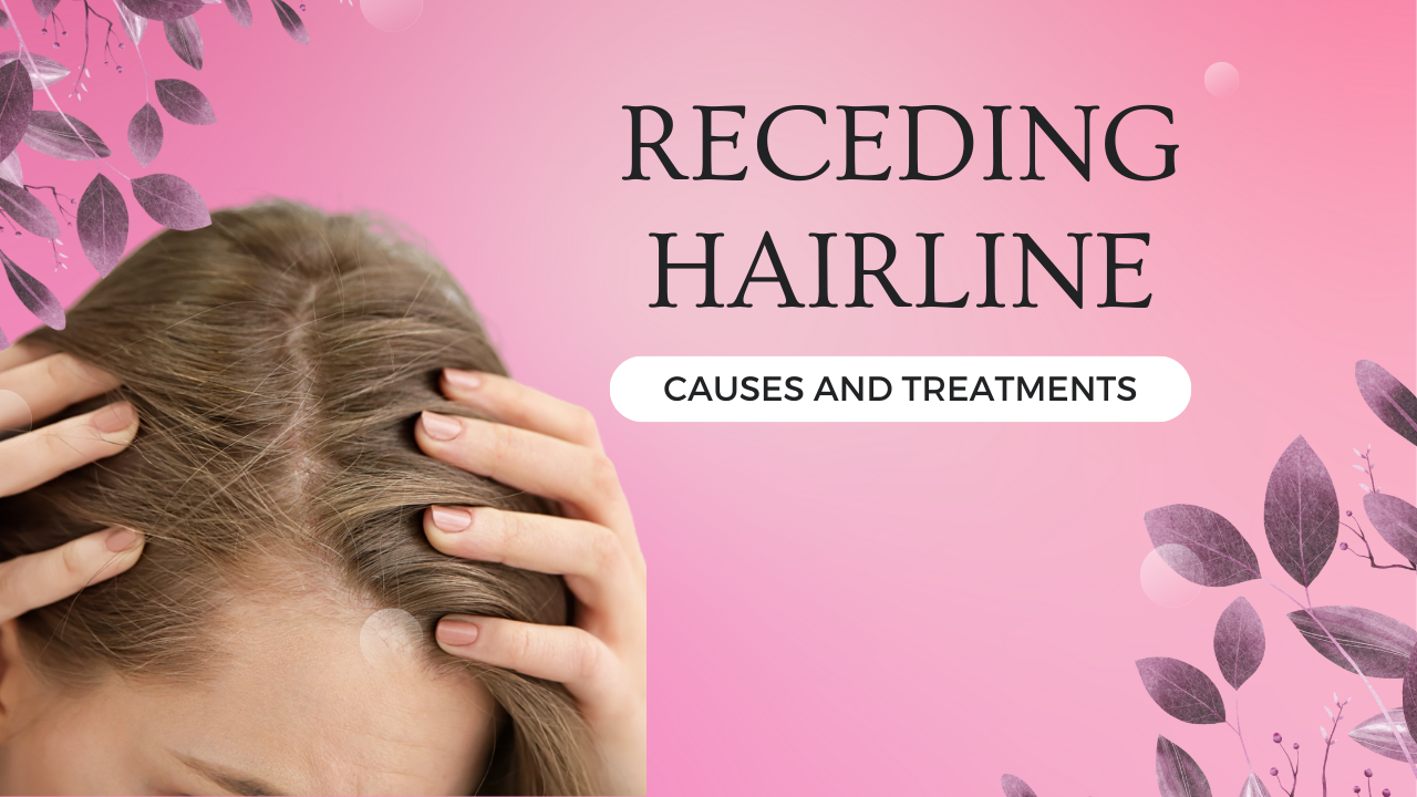 Receding Hairline – Causes and Treatments